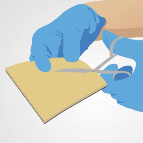 Silver dressings in wound care